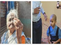Epidemi Rambut Rontok Gegerkan India, Bikin Botak dalam Seminggu