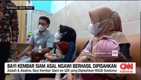 VIDEO: Bayi Kembar Siam Asal Ngawi Berhasil Dipisahkan