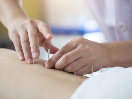 Manfaat Akupunktur Postpartum untuk Bunda Pasca Melahirkan, Ketahui Prosedur & Efeknya