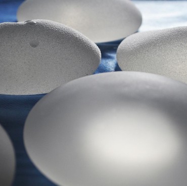 Mitos Implan Payudara Harus Diganti Setiap 5 Tahun Sekali? Ini Kata Ahli