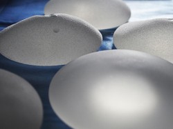 Mitos Implan Payudara Harus Diganti Setiap 5 Tahun Sekali? Ini Kata Ahli