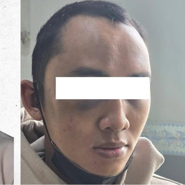 Sosok ASN Bandung Barat yang Jadi Korban KDRT Istri hingga Babak Belur