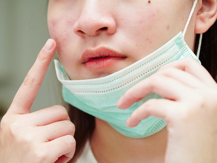 Viral Istilah Maskne, Kenali Lebih Jauh Kondisi Kulit Berjerawat karena Penggunaan Masker