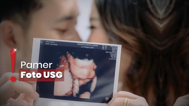 Pamer Foto Maternity Bareng Suami, Kiky Saputri Bocorkan Nama Anak