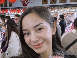 Alasan Kirana Larasati Pilih Operasi Hidung di Thailand