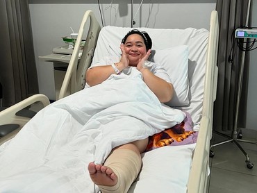 Sinyorita Esperanza Jatuh dari Tangga hingga Masuk RS, Begini Kondisi Terbarunya