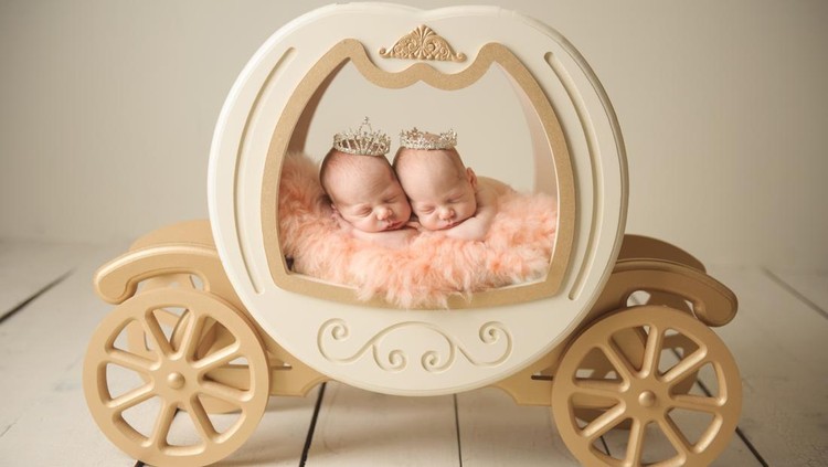 Bayi kembar