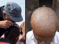 Misteri Kerontokan Rambut Massal Menimpa Penduduk Desa di India