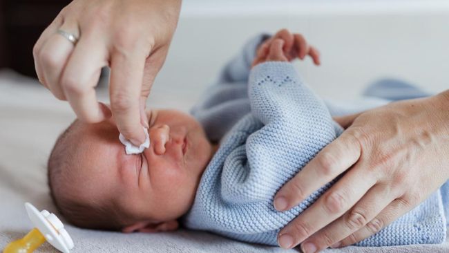7 Penyebab Mata Bayi Berair dan Cara Mengatasinya