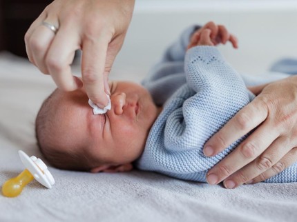 7 Penyebab Mata Bayi Berair dan Cara Mengatasinya