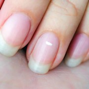 Pakar Ungkapkan Alasan Adanya Bintik Putih di Kuku, Bukan Isyarat Orang Rindu Tapi...