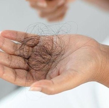Waspadai Dampak Serius dari Kebiasaan Sering Mencabut Rambut