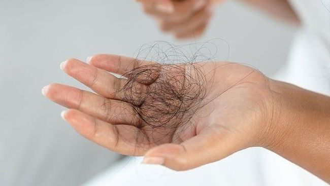Dampak Serius dari Kebiasaan Sering Mencabut Rambut
