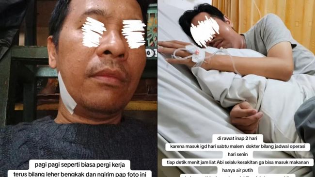 Viral di TikTok Pria Meninggal Dunia karena Gigi Berlubang, Ini Pesan dari Dokter Gigi...