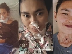 Cerita Wanita Salatiga Kena Kanker Laring Stadium 3, Sempat Dikira Radang Tenggorokan