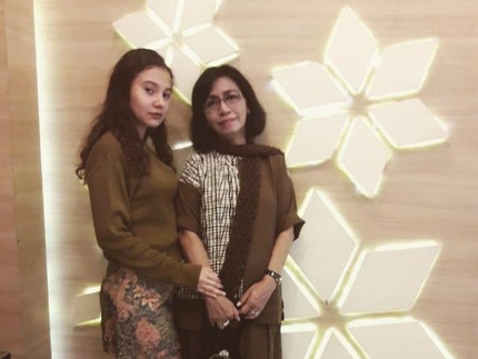 Cerita Larasati Nugroho, Ibunda Nantikan Kehamilan 10 Th hingga 3 Kali USG Terlihat Cowok