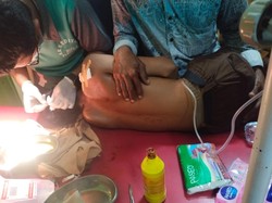 Polisi Buru Pembacok Tiga Siswa di Bima