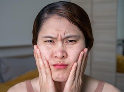 Rutinitas Skincare yang Cocok untuk Kulit Sensitif, Berminyak, dan Berjerawat