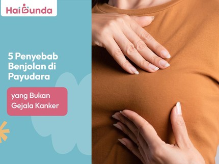 5 Penyebab Benjolan di Payudara yang Bukan Gejala Kanker