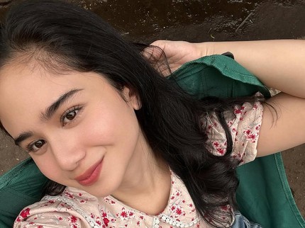 Cerita Tissa Biani Hadapi Kulit Berjerawat Selama 4 Tahun