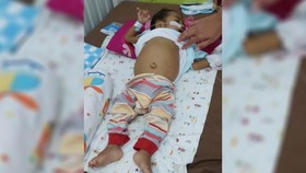 Bantu Bayi Castiel Sembuh dari Tumor Hati dengan Donasi di Berbuatbaik