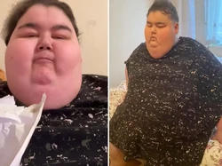 TikToker Mukbang Meninggal, Sefatal Ini Efeknya Jika Sering Makan Berlebihan