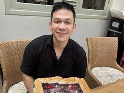 Bukan Sinus, Jordi Onsu Ungkap Alasan Operasi Plastik