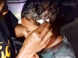 Kepala Bocah 8 Tahun di Lombok Timur Luka Akibat Perang Sarung