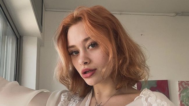 Sempat Koma 10 Hari, Model Ukraina yang Luka Parah di Pinggir Jalan Dubai Bersuara