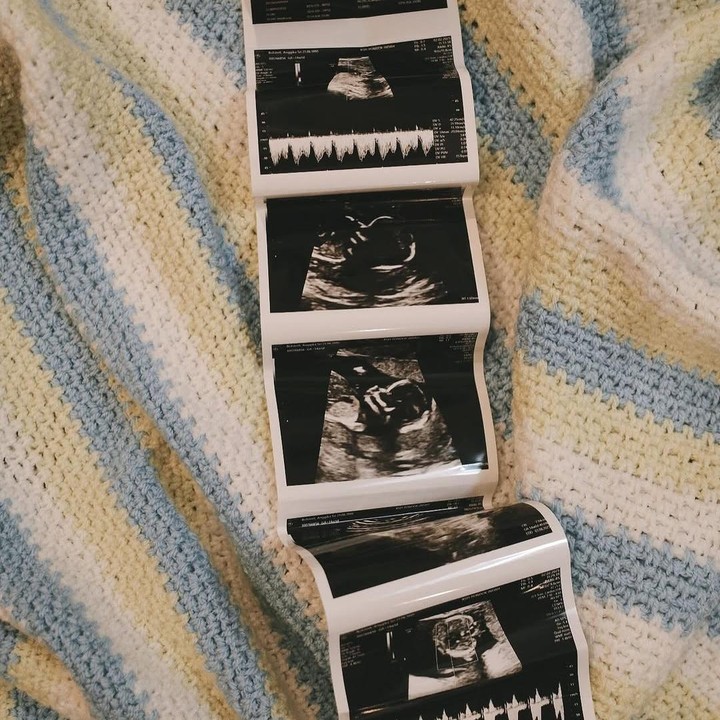 <p>Pada Februari 2025, Anggika pun membagikan kabar bahagia bahwa dirinya tengah berbadan dua. Ia mengunggah foto hasil USG janin ke akun Instagramnya. "<em>So much love wrapped around our little one,</em>" tulisnya. Foto: Instagram@anggikabolsterli</p>