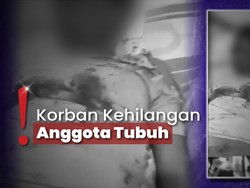 Makan Banyak Korban, Petasan dan Kembang Api Masih Dijual Bebas