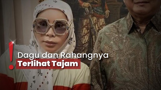 Tutupi Wajah Bengkak Diduga Oplas, Melly Goeslaw Rajin Pakai Kacamata