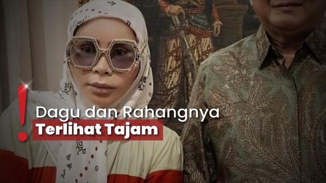 Tutupi Wajah Bengkak Diduga Oplas, Melly Goeslaw Rajin Pakai Kacamata