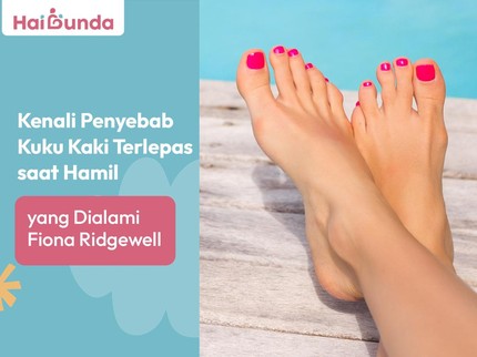 Kenali Penyebab Kuku Kaki Terlepas saat Hamil yang Dialami Fiona Ridgewell