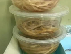 Video: Penampakan Cacing di Usus Bocah 3 Tahun di Jember