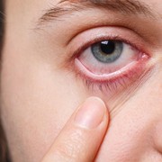 Waspada! 5 Perubahan pada Mata yang Sering Diabaikan, Bisa Jadi Tanda Bahaya Kesehatan