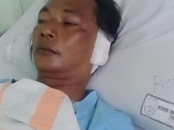 Hiii! Telinga Nelayan Pamekasan Tertancap Moncong Ikan Besar Saat Melaut
