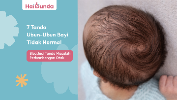7 Tanda Ubun-Ubun Bayi Tidak Normal, Bisa Jadi Tanda Masalah Perkembangan Otak