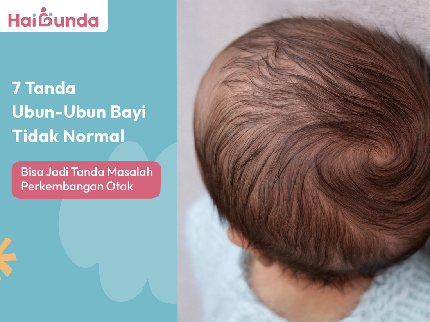 7 Tanda Ubun-Ubun Bayi Tidak Normal, Bisa Jadi Tanda Masalah Perkembangan Otak
