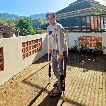 Adjie Pangestu Cedera Parah Akibat Basket, Tendon Achilles Sampai Putus