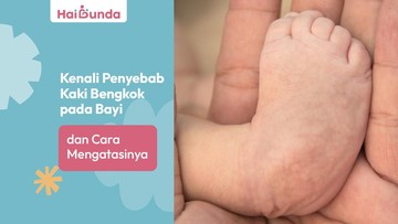 Kenali Penyebab Kaki Bengkok pada Bayi dan Cara Mengatasinya