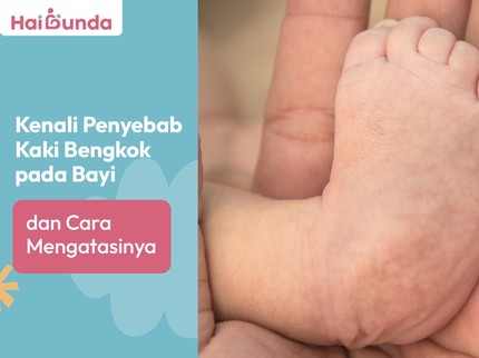 Kenali Penyebab Kaki Bengkok pada Bayi dan Cara Mengatasinya