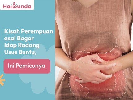 Kisah Perempuan asal Bogor Idap Radang Usus Buntu, Ini Pemicunya