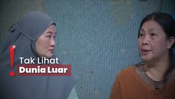 Vivi-Butet Korban Eksploitasi Eks Sirkus , Pengacara: Pelanggaran Berat