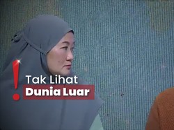 Vivi-Butet Korban Eksploitasi Eks Sirkus , Pengacara: Pelanggaran Berat