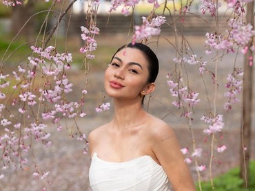 img-title Paras Dipuja Kaum Hawa, Ariel Tatum Ternyata Pernah Punya Kulit Belang