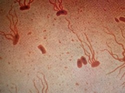 Penyakit Thypus Berkembang, Antibiotik Jadi Tidak Ampuh Lagi