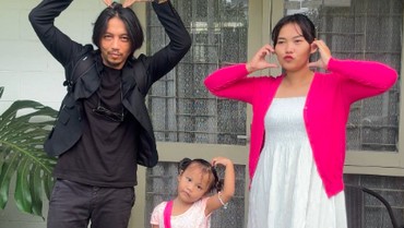 Kondisi Istri Fiersa Besari Usai Insiden Ditabrak Mobil