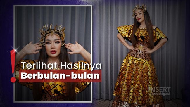 Makin Jadi Tren, Asri Welas-Titi DJ Rela Rogoh Kocek Oplas di Korsel