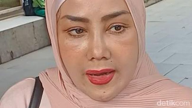 Tak Percaya Diri, Rency Milano Rela Rogoh Kocek Ratusan Juta untuk Oplas